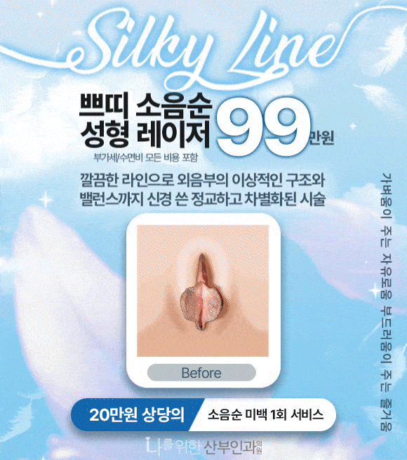 쁘띠 소음순 성형 레이저