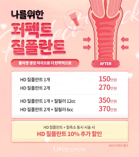 나를위한 퍼펙트 질플란트