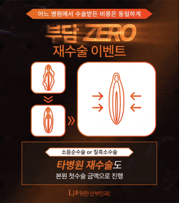 부담ZERO 재수술 이벤트
