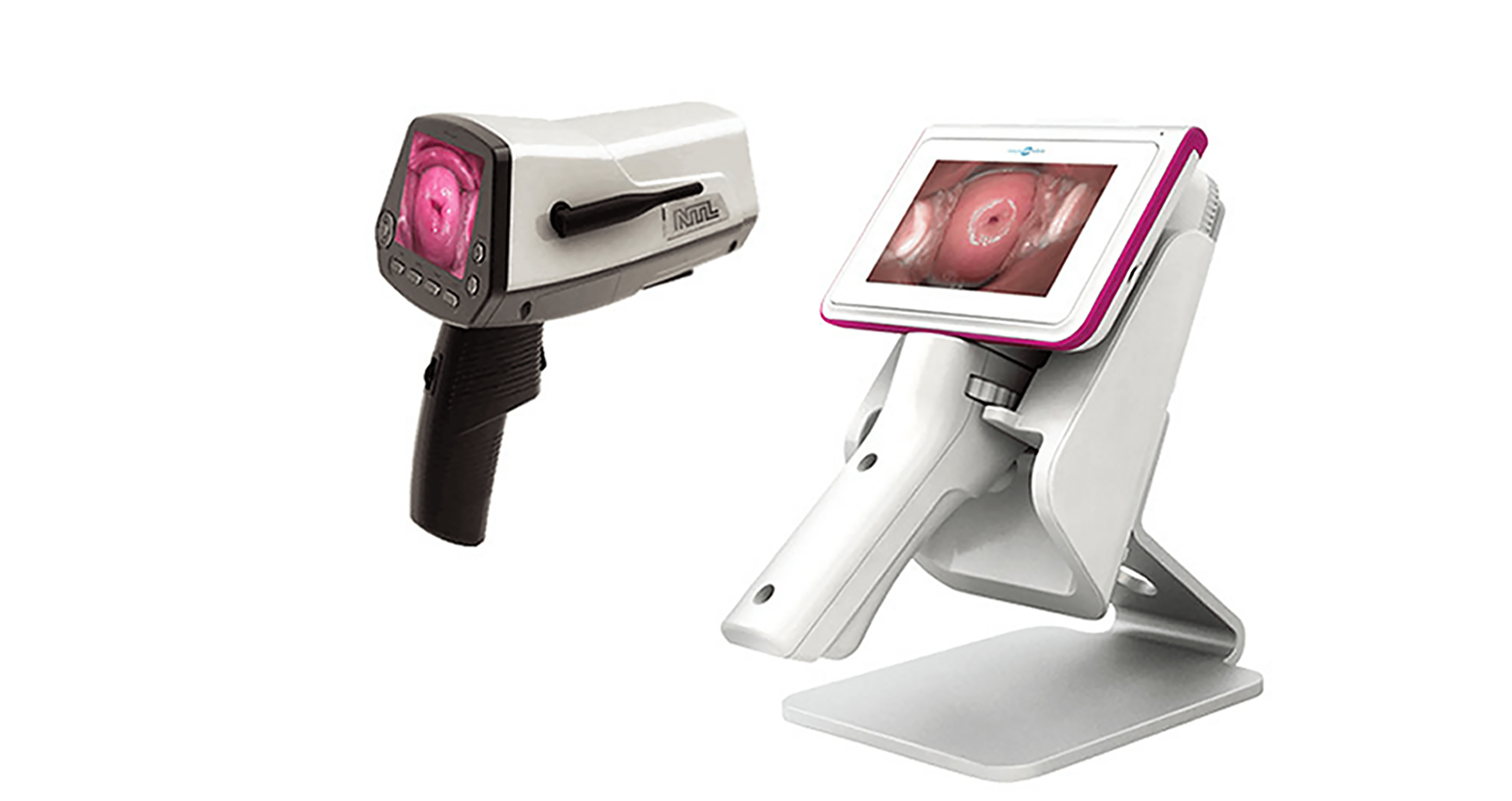 자궁경부암 텔레써비코 검사