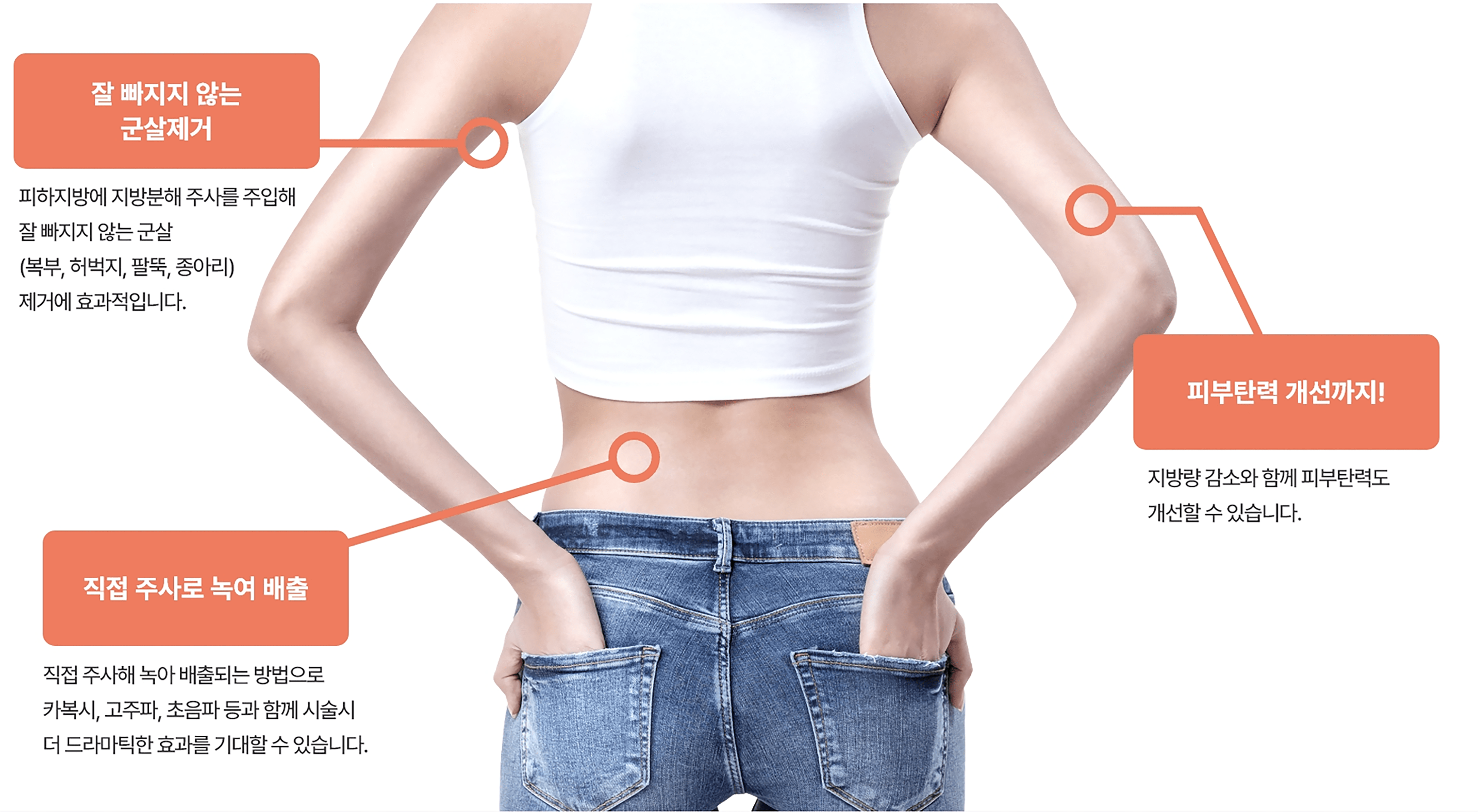 리포 주사 특징