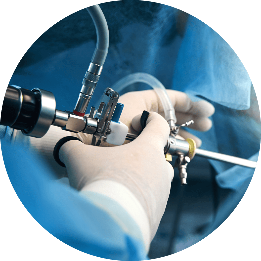 정확하고 섬세한 치료