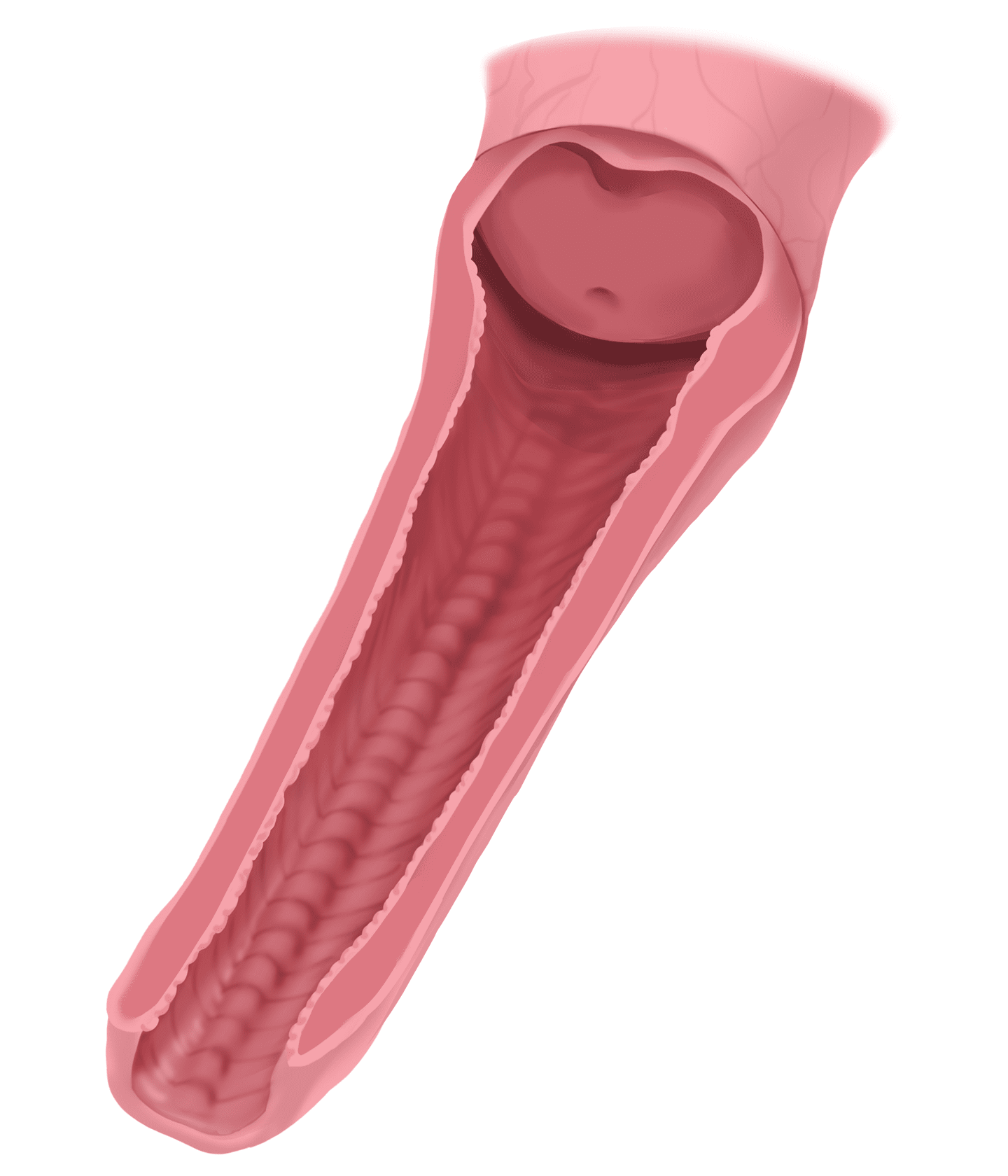 골반근육강화술