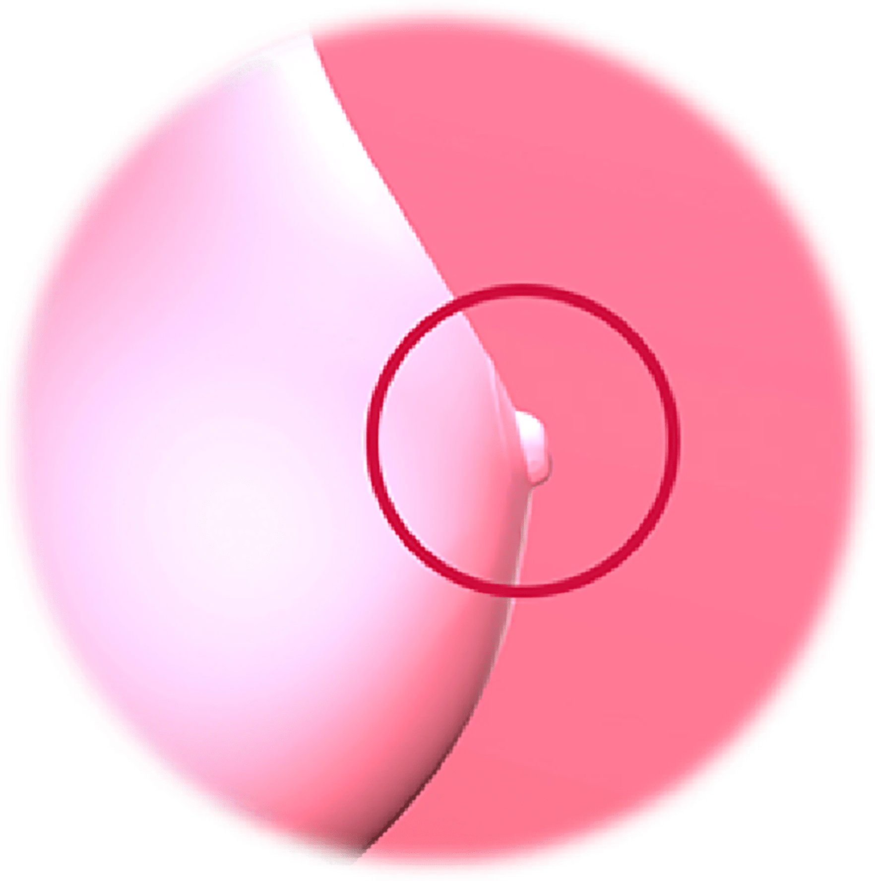 함몰유두의 종류