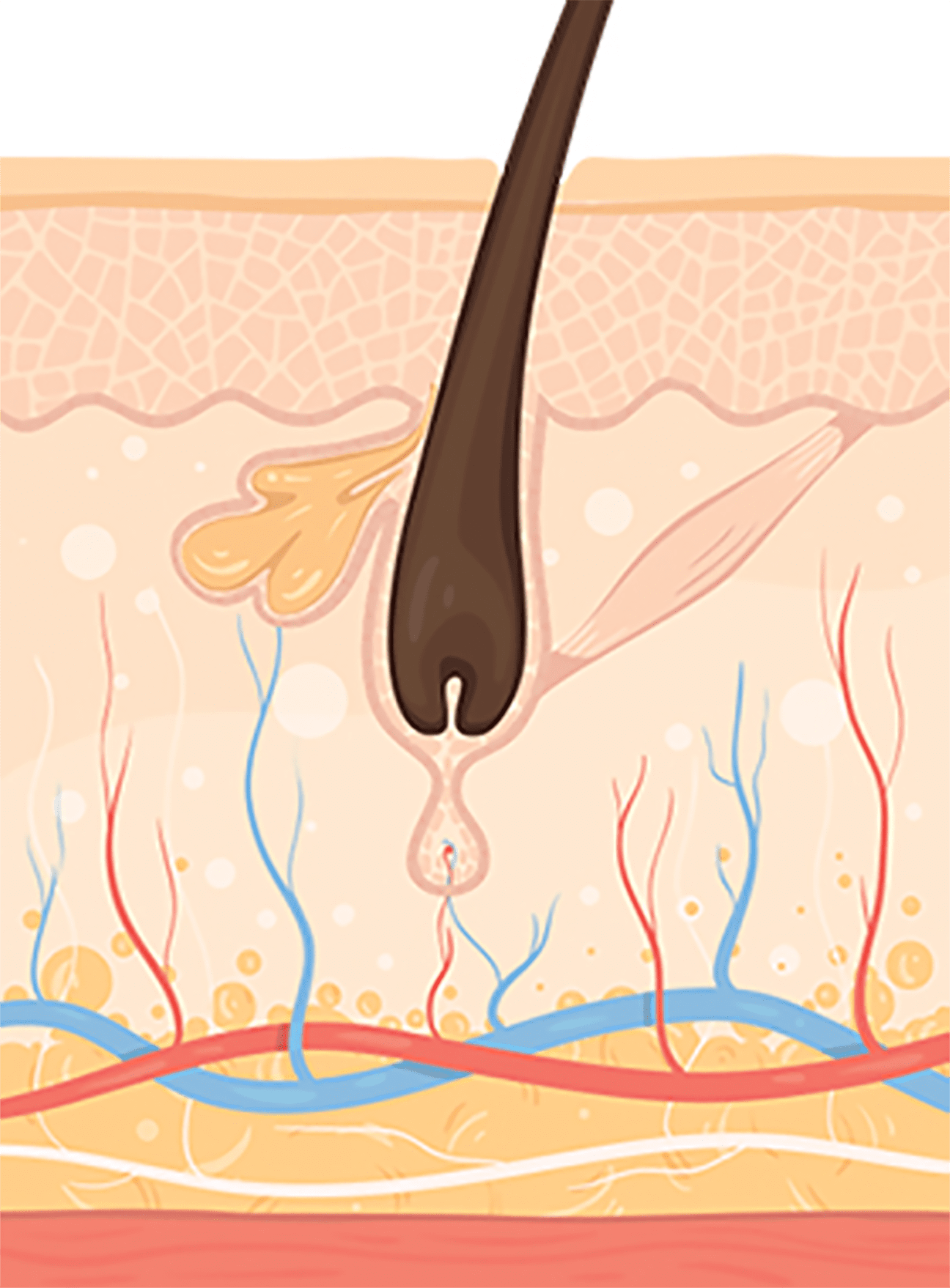 모발 탈락 및 모낭 파괴